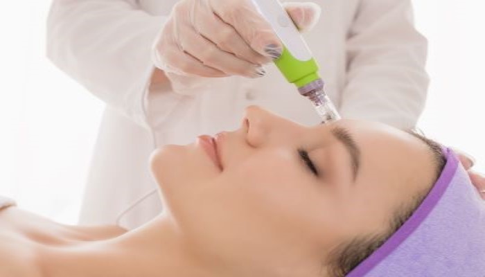 Skin doctor in rajkot doing acne / pimples scars treatment with dermapen